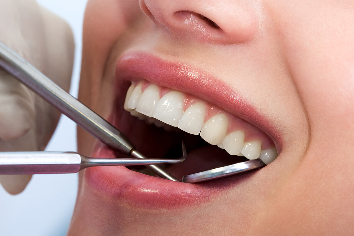 Teeth Whitening Dentist in Mesa AZ Area